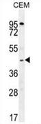 Zinc Finger MYND-Type Containing 10 antibody, AP54658PU-N, Origene, Western Blot image 