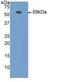 Carboxypeptidase N Subunit 1 antibody, abx101847, Abbexa, Western Blot image 