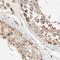 Translational Activator Of Cytochrome C Oxidase I antibody, PA5-55043, Invitrogen Antibodies, Immunohistochemistry paraffin image 