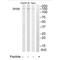 DEAH-Box Helicase 8 antibody, A11805, Boster Biological Technology, Western Blot image 