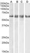 Gamma-Aminobutyric Acid Type A Receptor Gamma2 Subunit antibody, orb385478, Biorbyt, Western Blot image 