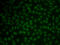 KH RNA Binding Domain Containing, Signal Transduction Associated 3 antibody, 22-370, ProSci, Immunofluorescence image 