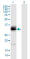 Proenkephalin-A antibody, H00005179-M04, Novus Biologicals, Western Blot image 