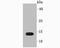 Profilin 1 antibody, A01480, Boster Biological Technology, Western Blot image 