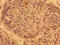 Peptide Deformylase, Mitochondrial antibody, CSB-PA872538LA01HU, Cusabio, Immunohistochemistry frozen image 