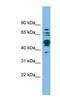 Serine Hydroxymethyltransferase 1 antibody, NBP1-53192, Novus Biologicals, Western Blot image 