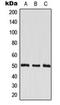 Eukaryotic Translation Elongation Factor 1 Gamma antibody, orb216090, Biorbyt, Western Blot image 