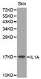 Interleukin 1 Alpha antibody, STJ113557, St John