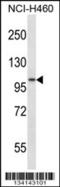 ADAM Metallopeptidase Domain 8 antibody, 57-450, ProSci, Western Blot image 