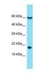 Neurofilament Medium antibody, orb331343, Biorbyt, Western Blot image 