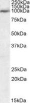 Ubiquitin Specific Peptidase 20 antibody, orb18564, Biorbyt, Western Blot image 