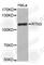 Reticulon 3 antibody, A4402, ABclonal Technology, Western Blot image 