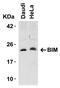 BCL2 Like 11 antibody, GTX31697, GeneTex, Western Blot image 