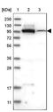 Integrin Subunit Beta 6 antibody, NBP2-14136, Novus Biologicals, Western Blot image 
