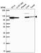 Adaptor Related Protein Complex 1 Subunit Beta 1 antibody, HPA065226, Atlas Antibodies, Western Blot image 