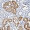 Phosphoenolpyruvate carboxylase antibody, HPA006507, Atlas Antibodies, Immunohistochemistry frozen image 