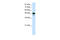 Neuronal Differentiation 2 antibody, 27-485, ProSci, Western Blot image 