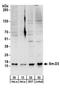 Small Nuclear Ribonucleoprotein D3 Polypeptide antibody, A303-953A, Bethyl Labs, Western Blot image 