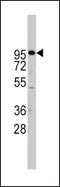 ADAM Metallopeptidase Domain 17 antibody, PA5-11573, Invitrogen Antibodies, Western Blot image 