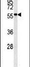 NGFI-A Binding Protein 2 antibody, PA5-14643, Invitrogen Antibodies, Western Blot image 