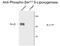 ALOX5 antibody, GTX82744, GeneTex, Western Blot image 