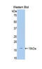 ADAM Metallopeptidase With Thrombospondin Type 1 Motif 1 antibody, LS-C304146, Lifespan Biosciences, Western Blot image 