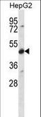 Cerebellar Degeneration Related Protein 2 antibody, LS-C168633, Lifespan Biosciences, Western Blot image 