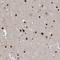 TSPY Like 1 antibody, NBP2-38191, Novus Biologicals, Immunohistochemistry paraffin image 