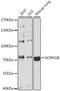 Sodium Channel Epithelial 1 Beta Subunit antibody, 18-027, ProSci, Western Blot image 