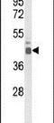 E74 Like ETS Transcription Factor 3 antibody, PA5-26451, Invitrogen Antibodies, Western Blot image 