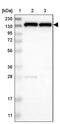 Ubiquitination Factor E4B antibody, PA5-53958, Invitrogen Antibodies, Western Blot image 