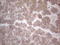 Hepatocellular carcinoma-associated protein TD26 homolog antibody, CF808842, Origene, Immunohistochemistry frozen image 