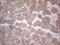 Hepatocellular carcinoma-associated protein TD26 homolog antibody, CF808842, Origene, Immunohistochemistry frozen image 