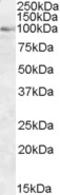 Oxysterol-binding protein 1 antibody, LS-C55214, Lifespan Biosciences, Western Blot image 