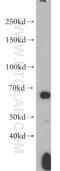 Protein Kinase AMP-Activated Catalytic Subunit Alpha 2 antibody, 18167-1-AP, Proteintech Group, Western Blot image 