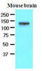 EPH Receptor A2 antibody, LS-B3002, Lifespan Biosciences, Western Blot image 