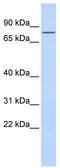 Zinc Finger Protein 354A antibody, TA333937, Origene, Western Blot image 