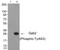 GRB2 Associated Binding Protein 2 antibody, PA5-37778, Invitrogen Antibodies, Western Blot image 