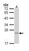 TNF Alpha Induced Protein 8 antibody, NBP1-33406, Novus Biologicals, Western Blot image 