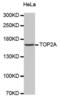 DNA Topoisomerase II Alpha antibody, abx000841, Abbexa, Western Blot image 
