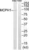 Microcephalin 1 antibody, abx015203, Abbexa, Western Blot image 