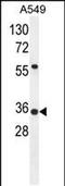 Sosondowah Ankyrin Repeat Domain Family Member D antibody, PA5-48293, Invitrogen Antibodies, Western Blot image 