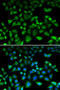 NHL Repeat Containing E3 Ubiquitin Protein Ligase 1 antibody, STJ28752, St John