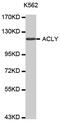 ATP Citrate Lyase antibody, MBS125583, MyBioSource, Western Blot image 