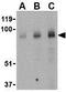 BR Serine/Threonine Kinase 1 antibody, GTX85054, GeneTex, Western Blot image 