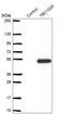 TBC1 Domain Family Member 20 antibody, HPA043613, Atlas Antibodies, Western Blot image 