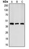 Creatine Kinase, M-Type antibody, MBS820920, MyBioSource, Western Blot image 