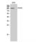 Collagen Type VI Alpha 2 Chain antibody, LS-C382822, Lifespan Biosciences, Western Blot image 