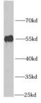 Peter Pan Homolog antibody, FNab06658, FineTest, Western Blot image 