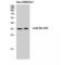 JunB Proto-Oncogene, AP-1 Transcription Factor Subunit antibody, LS-C384243, Lifespan Biosciences, Western Blot image 